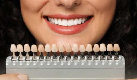 Estetik Diş Modelleri