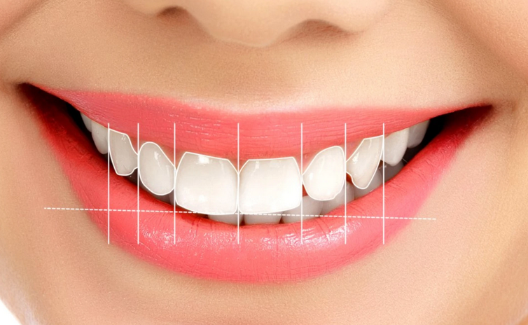 Doğal Diş Estetiği