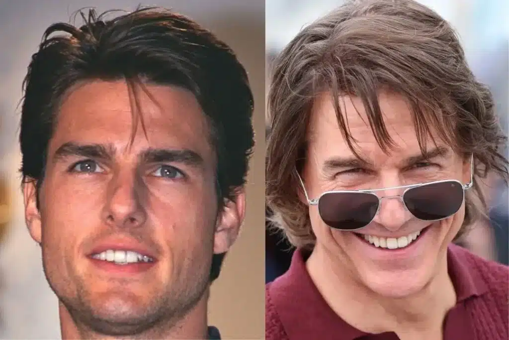 Hollywood Gülüşüyle Tom Cruise'un Dönüşümü